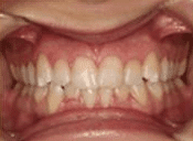 Before image of dental patient 15
