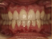 Before image of dental patient 17