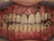 Before image of patient with dental concerns