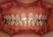 Before image of dental patient 2