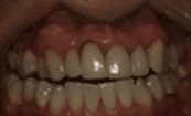 Before image of dental patient