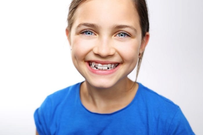 orthodontic appliances in Kanata, Ottawa, and Stittsville