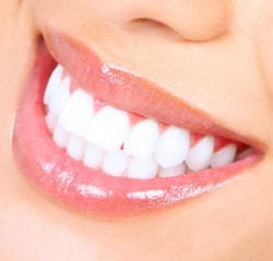 What Are My Options For Teeth Whitening