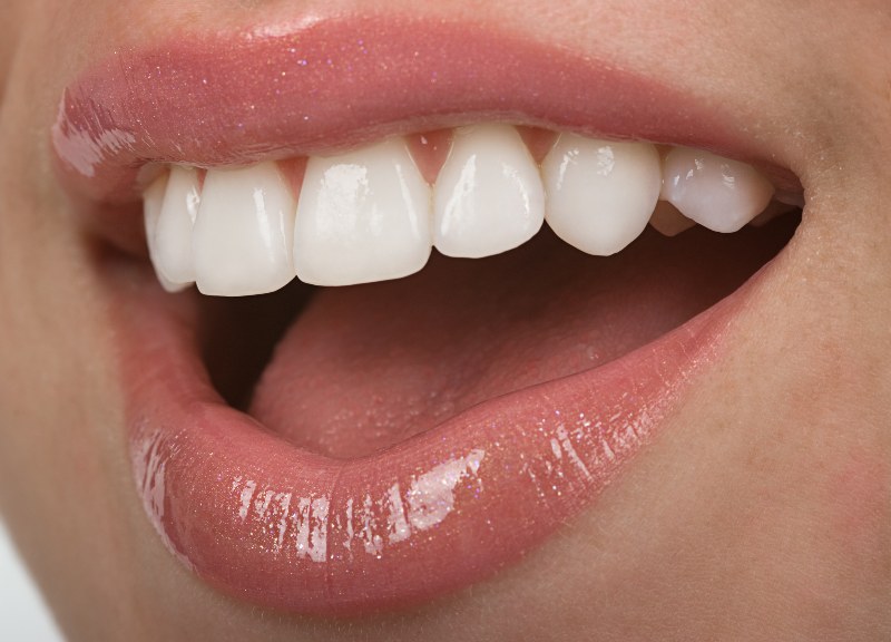 Close up of straight white teeth by Villanova Dental Studio