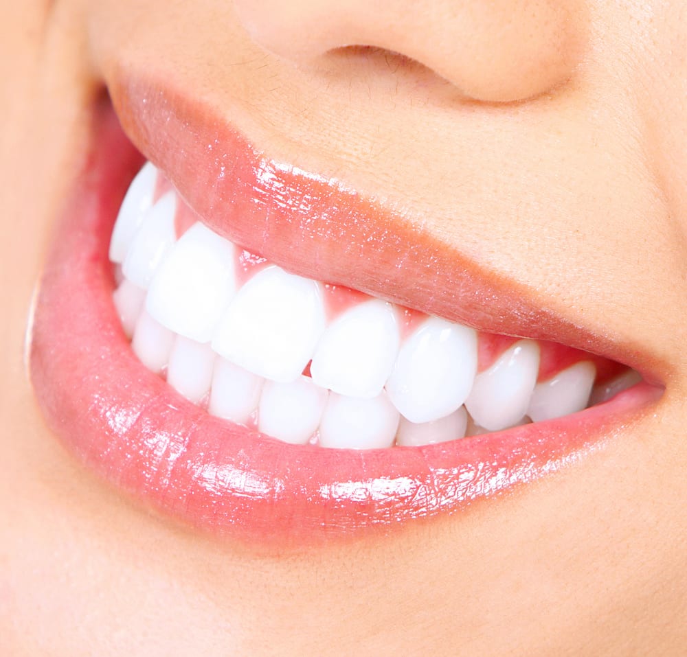 Women happily smiling with confidence after teeth whitening treatment, Kanata ON
