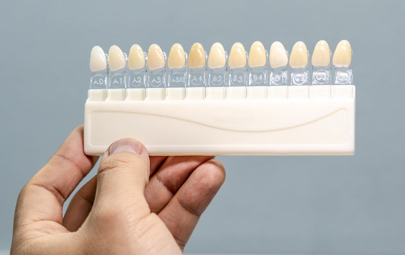 A tooth shade guide by Villanova Dental Studio