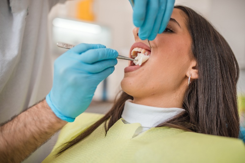 Dentist applying composite resin during a tooth bonding procedure on a patient for cosmetic dental repair in Kanata and Stittsville, ON